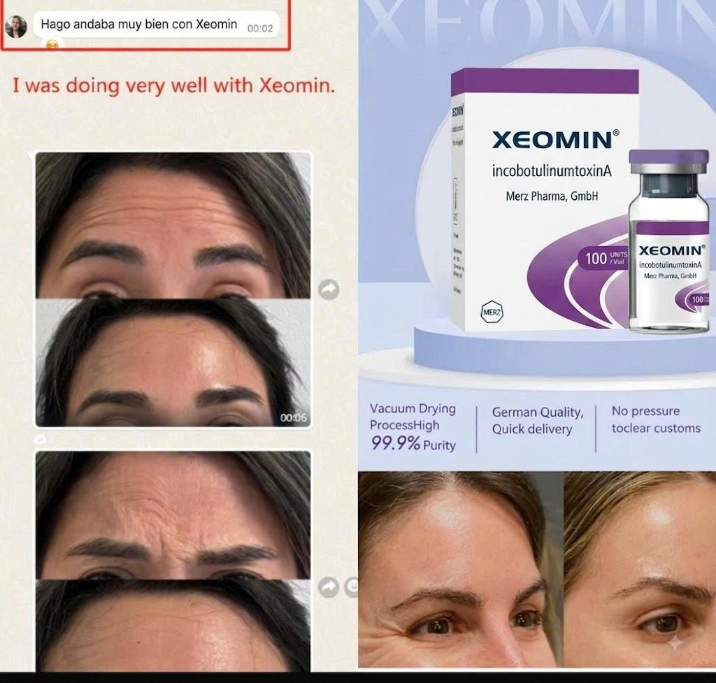 botox